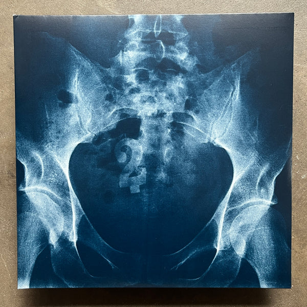 Various – Antipodean Anomalies 2