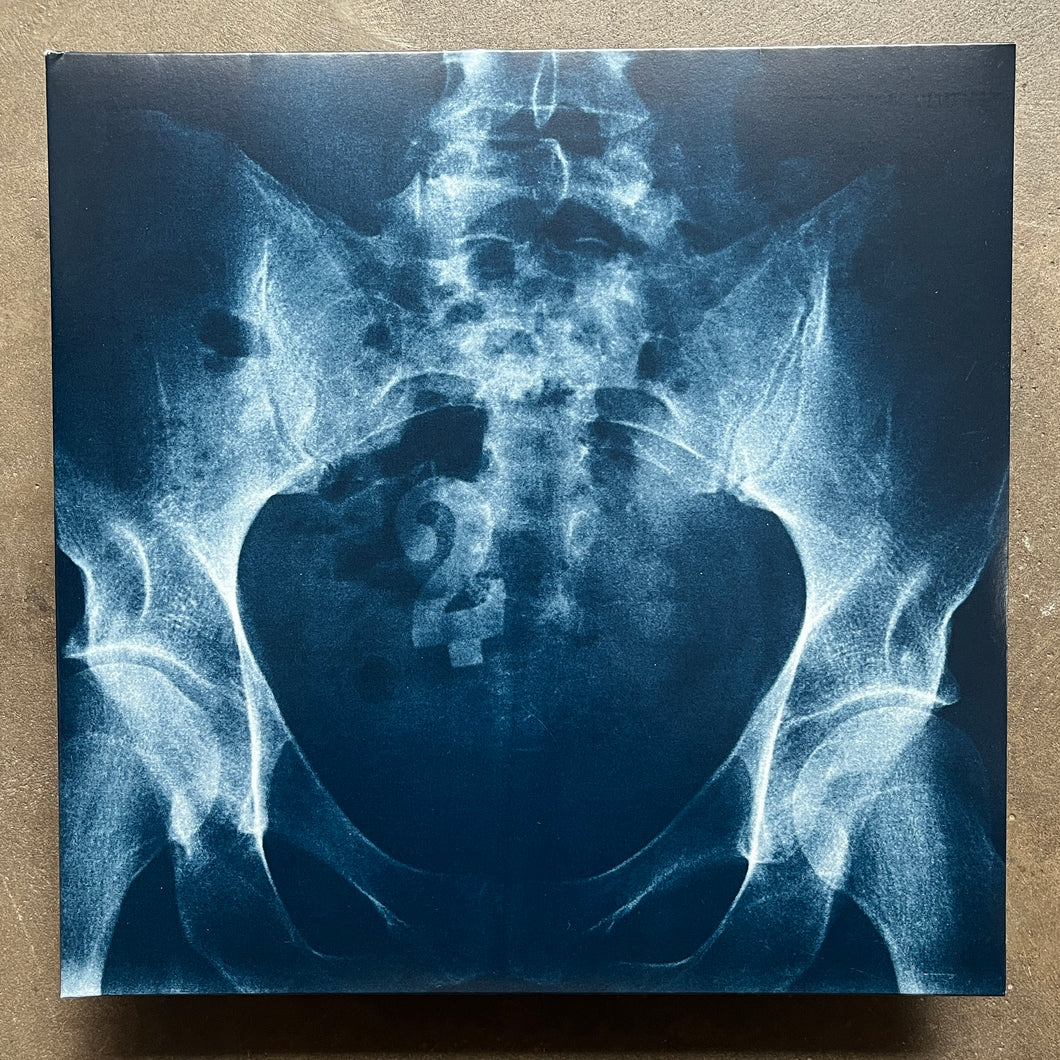 Various – Antipodean Anomalies 2